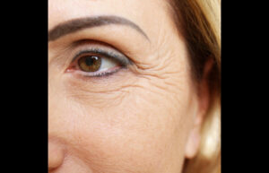 retinol cream for wrinkles